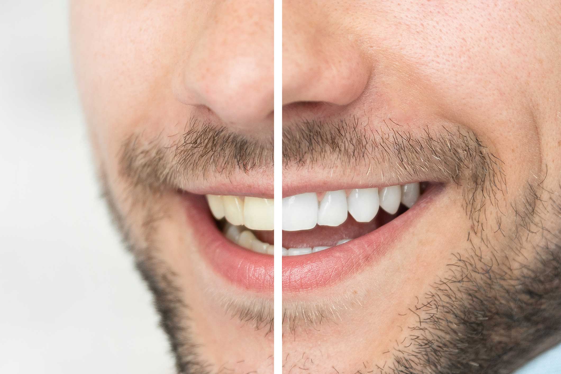 Dentista en Igualada, Clínica Dental en Igualada, Estética dental en Igualada