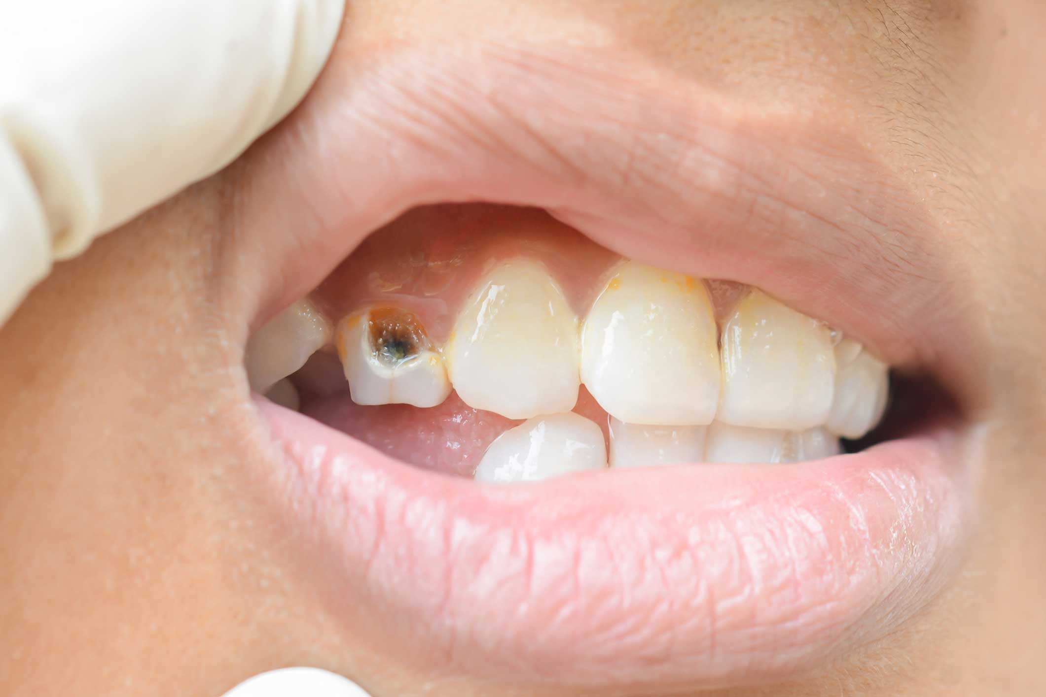 Dentista en Igualada, Clínica Dental en Igualada, odontopediatría en Igualada