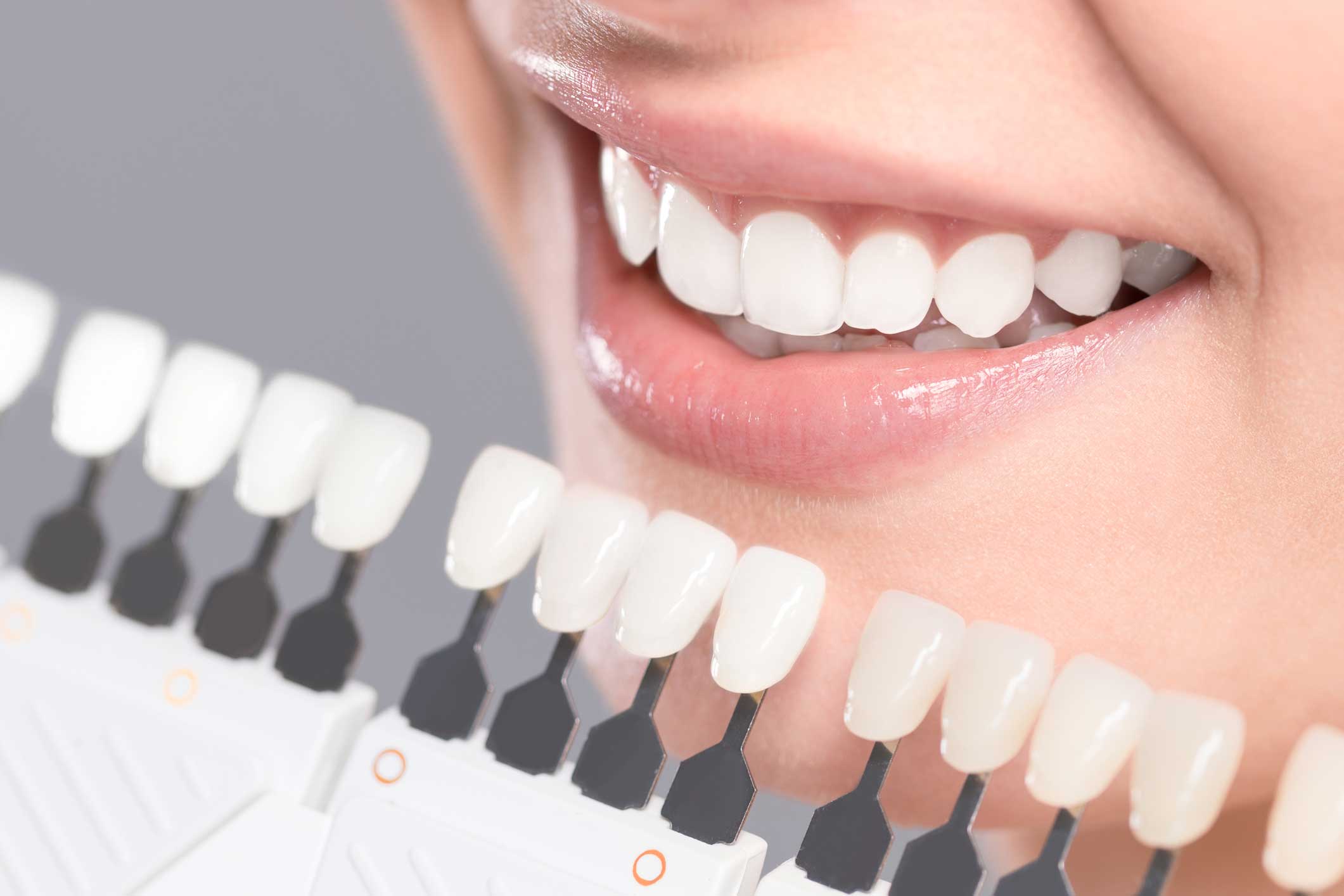 Dentista en Igualada, Clínica Dental en Igualada, Estética dental en Igualada