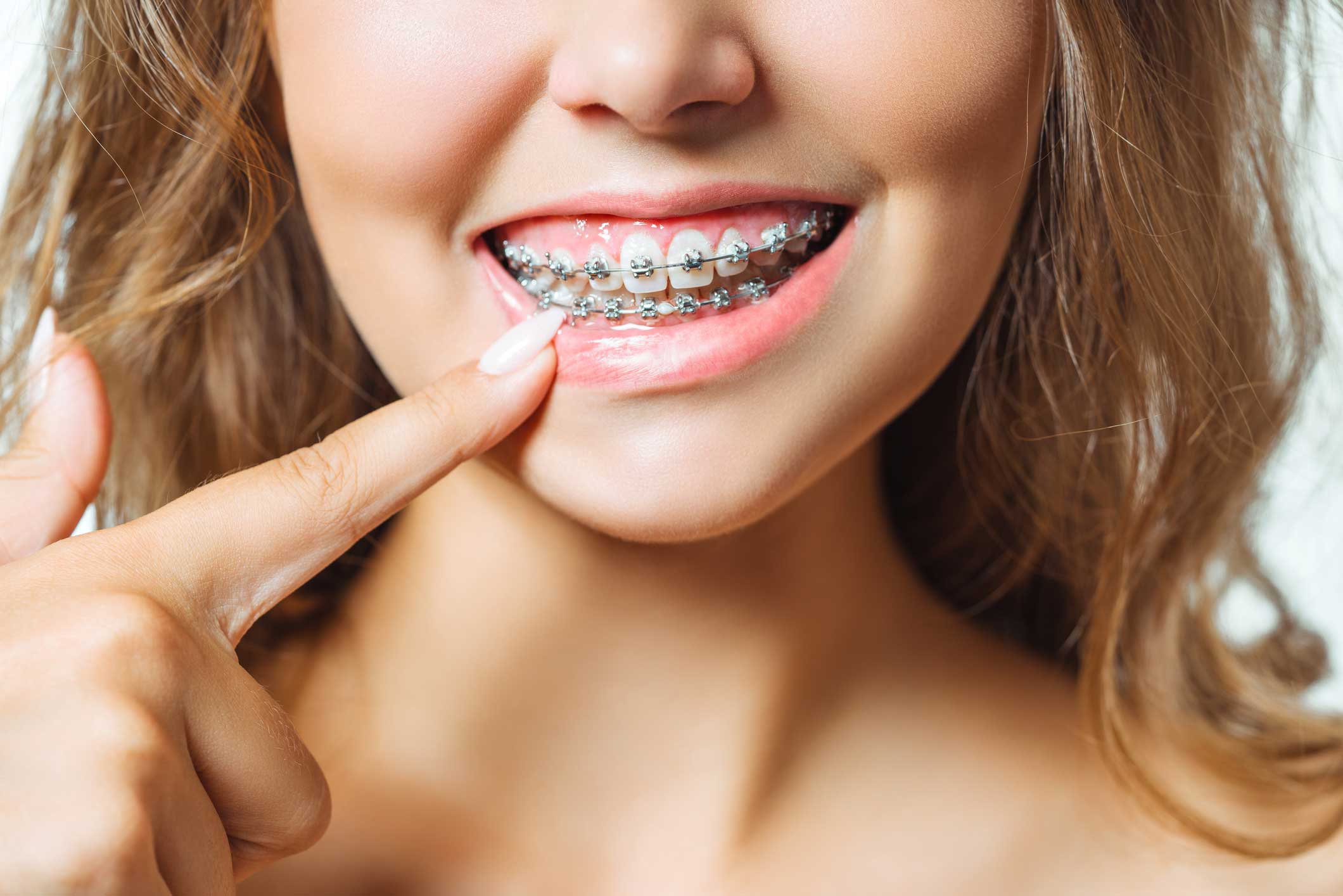 Dentista en Igualada, Clínica Dental en Igualada, ortodoncia en Igualada
