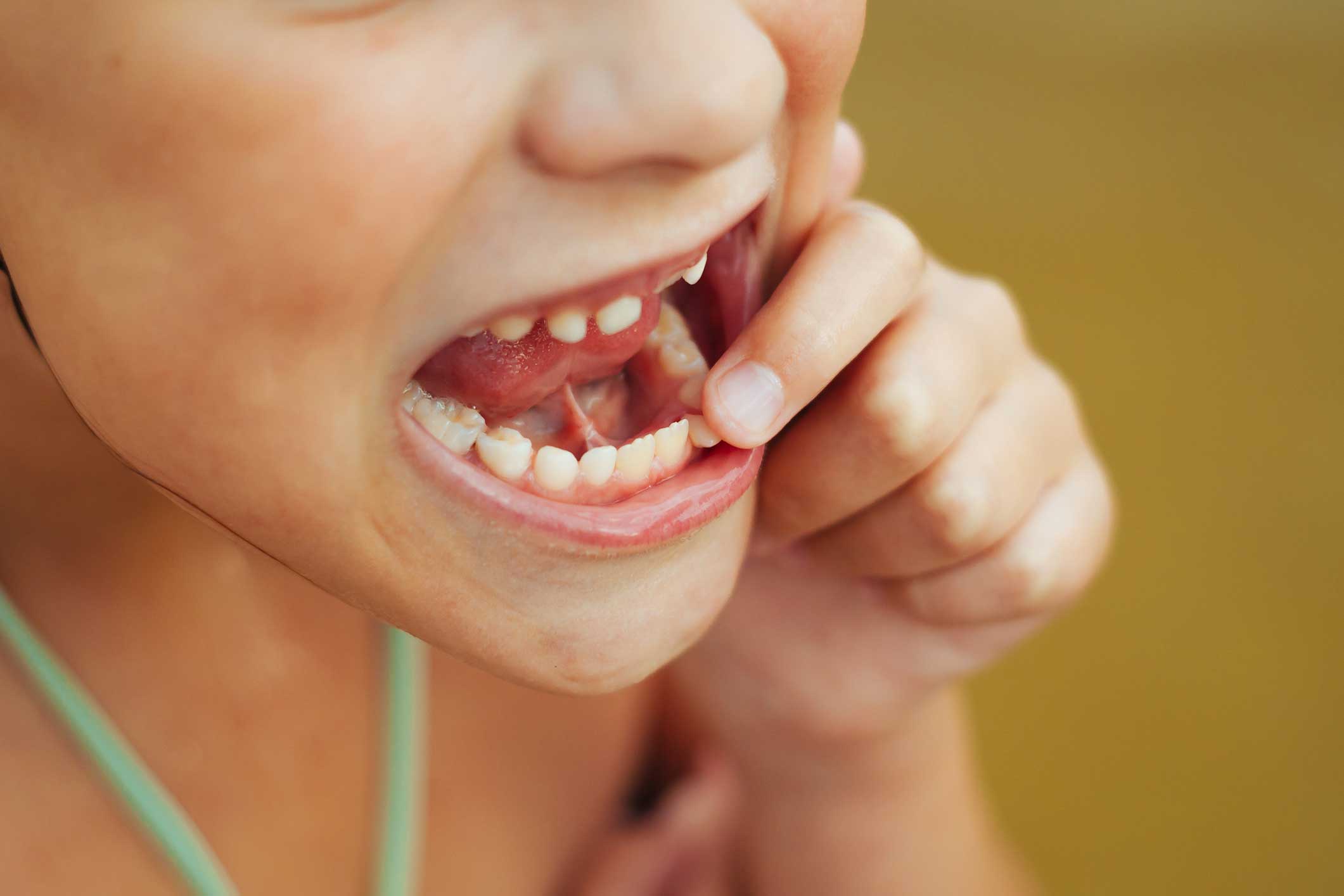 Dentista en Igualada, Clínica Dental en Igualada, odontopediatría en Igualada