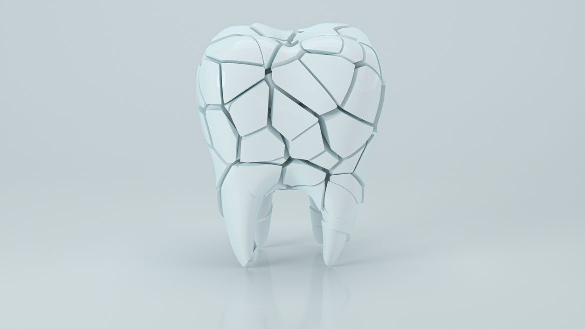 ¿Qué es el desgaste dental?