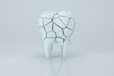 ¿Qué es el desgaste dental?